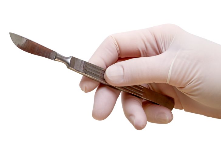 Gloved hand holding a surgical scalpel