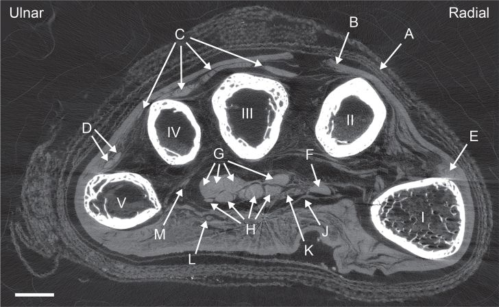 Cross-section of mummy hand.